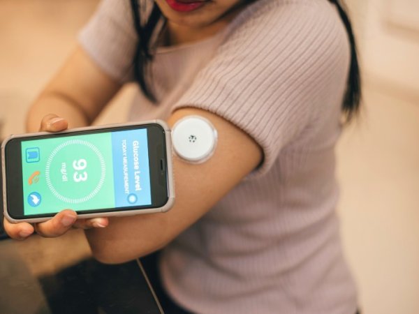 Sensor de glucosa: ¿cómo funciona y quiénes lo necesitan?