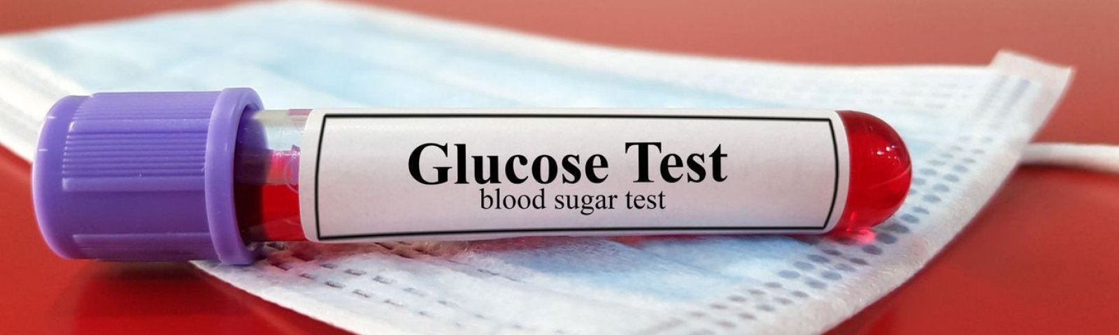 Examen de glucosa: ¿Qué es y para qué sirve?
