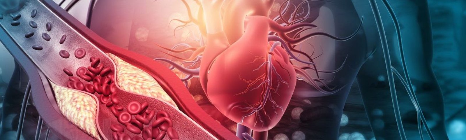 Enfermedades cardiovasculares: factores de riesgo y cómo prevenirlas