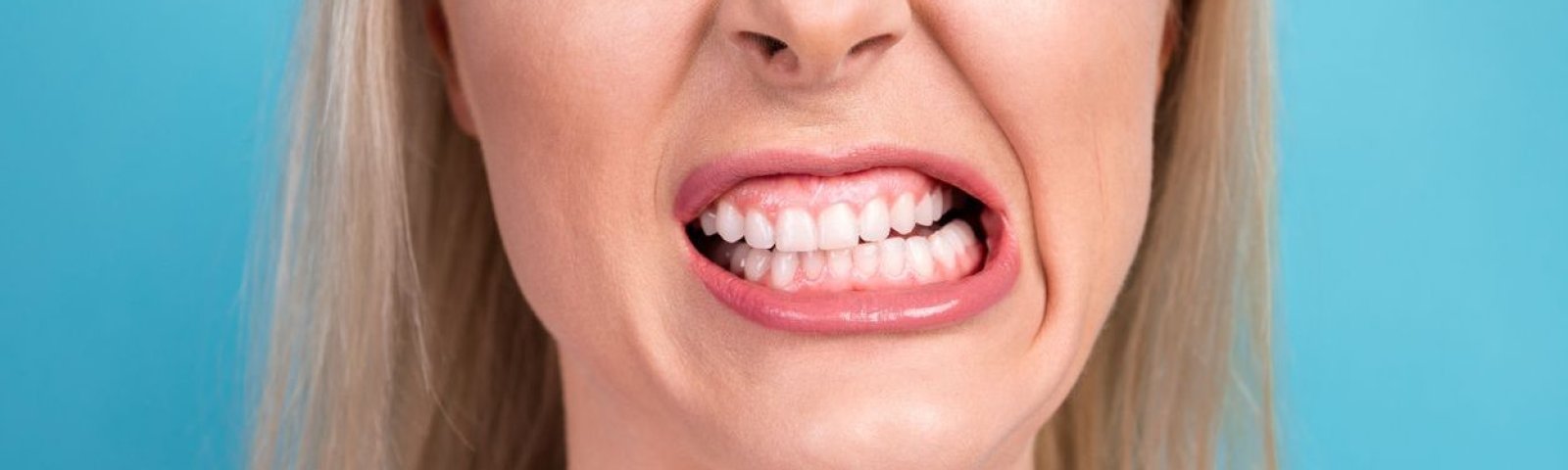 ¿Qué es el bruxismo? Síntomas, causas y tratamiento
