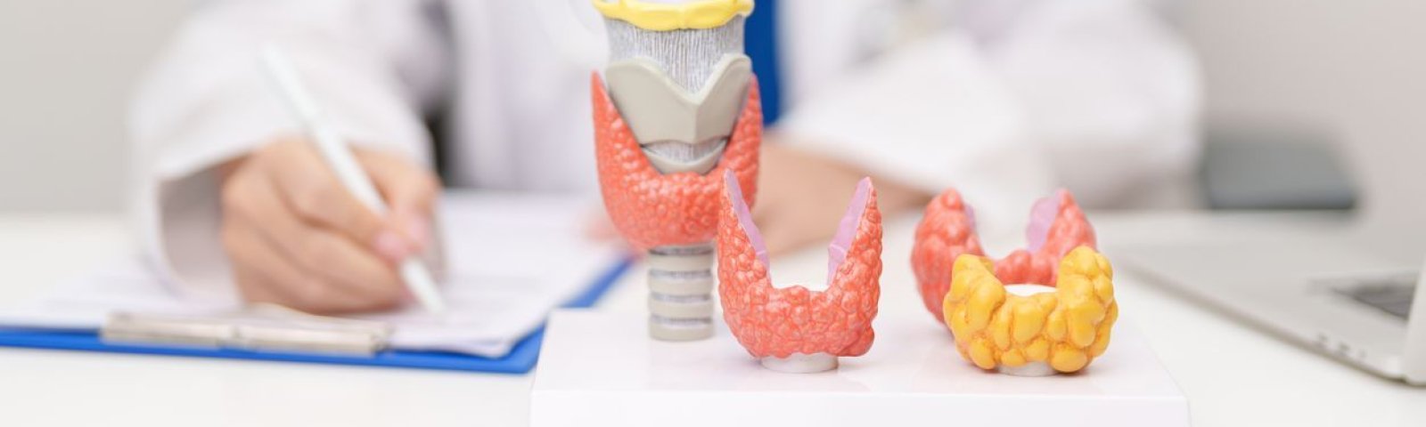 Tiroiditis de Hashimoto: la enfermedad de tiroides que muchas mujeres tienen sin saberlo