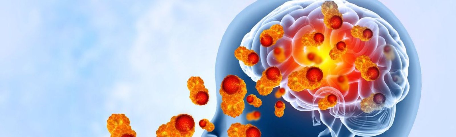 Meningitis: qué es, cómo se contagia y cómo prevenirla con vacunas