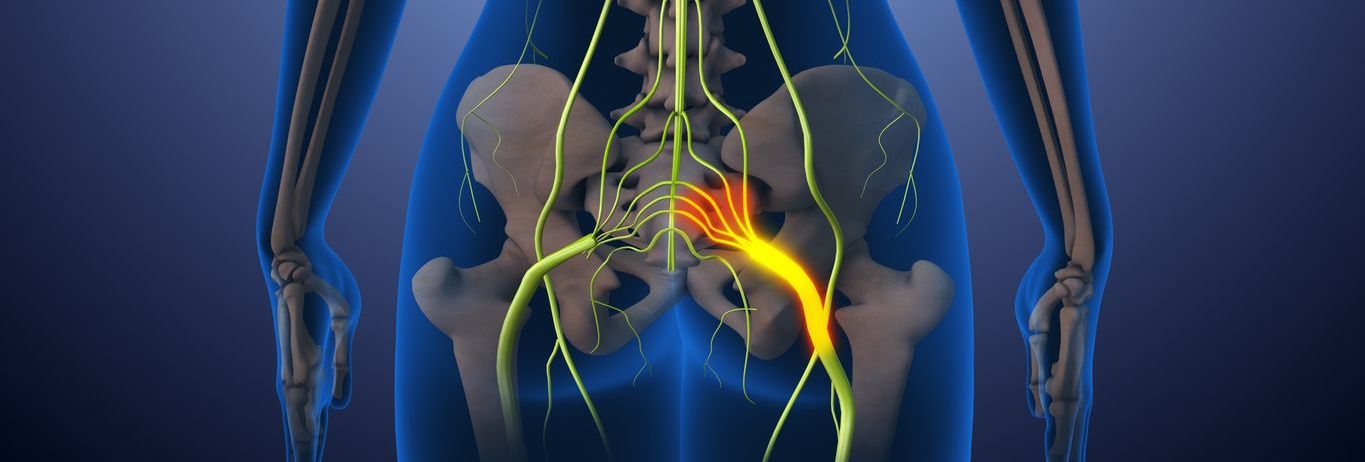 Nervio ciático: qué es, por qué duele y cómo aliviar el dolor